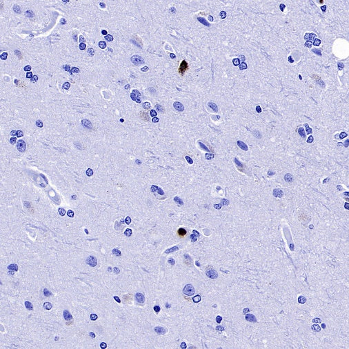 Lipocalin-2/NGAL Recombinant Rabbit mAb (S-2279-72)