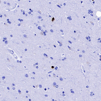 Lipocalin-2/NGAL Recombinant Rabbit mAb (S-2279-72)