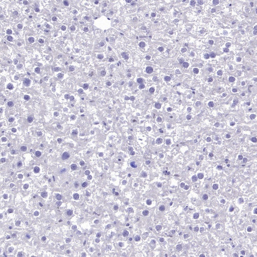 LIN28A Rabbit Polyclonal Antibody