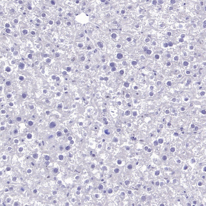 LIN28A Rabbit Polyclonal Antibody