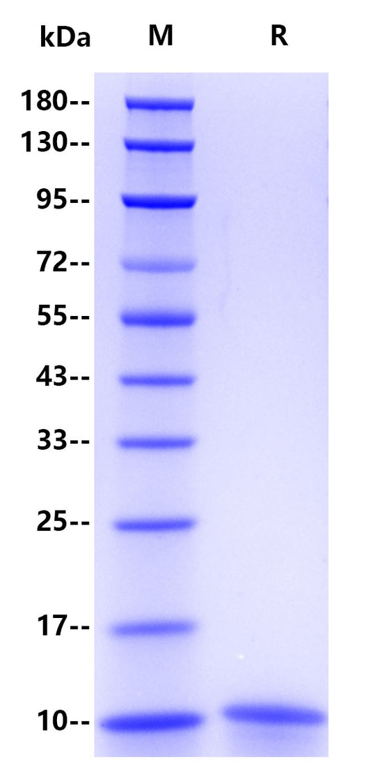Human CD81, His Tag