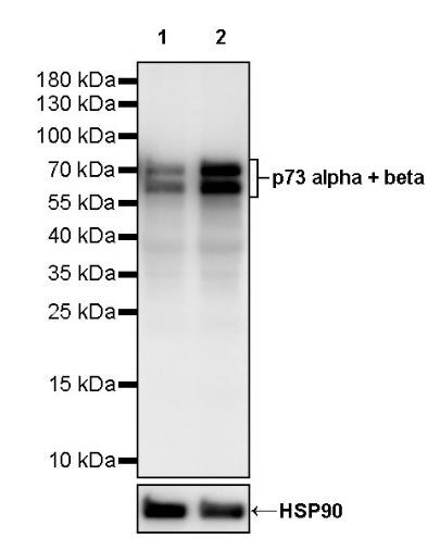 p73 alpha + beta Recombinant Rabbit mAb (S-2565-27)