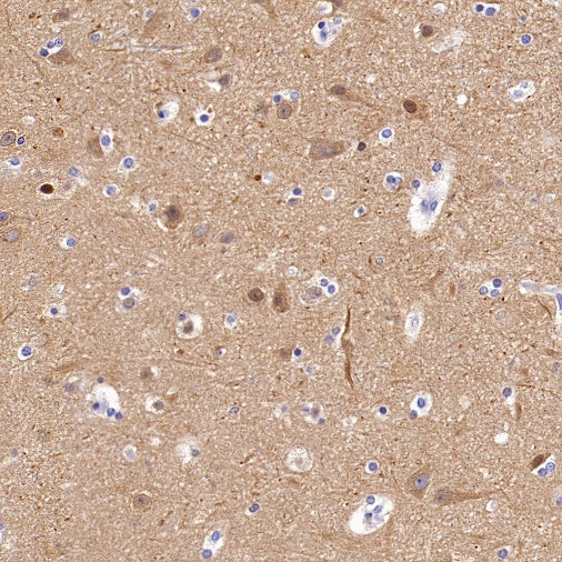 Beta I tubulin Recombinant Rabbit mAb (S-3108-63)