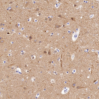 Beta I tubulin Recombinant Rabbit mAb (S-3108-63)
