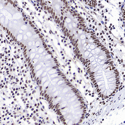 PTBP1 Rabbit Polyclonal Antibody