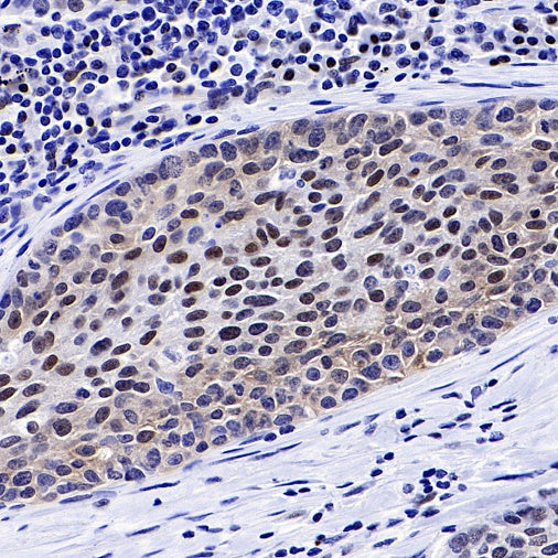 FoxO3a Recombinant Rabbit mAb (S-465-41)