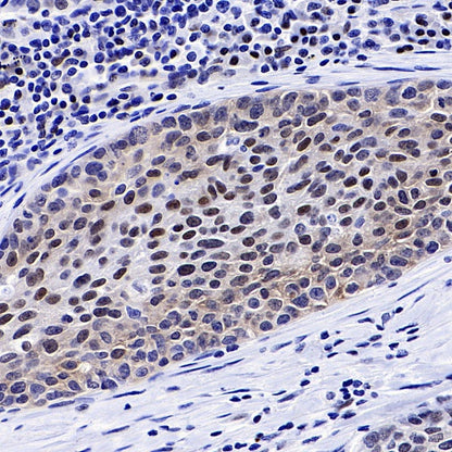 FoxO3a Recombinant Rabbit mAb (S-465-41)