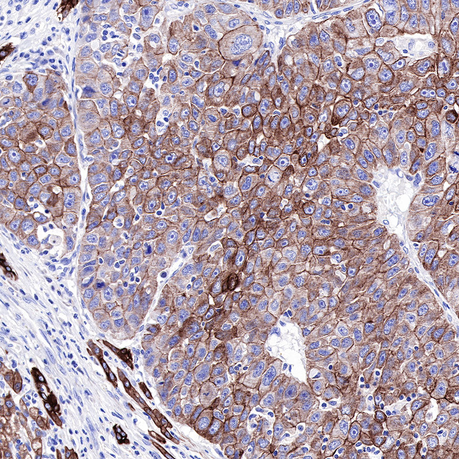 S-RMab® CK-Pan Recombinant Rabbit mAb,PBS Only (SDT-P001)