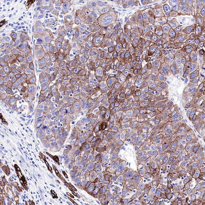S-RMab® CK-Pan Recombinant Rabbit mAb,PBS Only (SDT-P001)