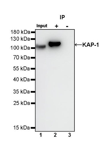 KAP-1 Recombinant Rabbit mAb (S-986-5)