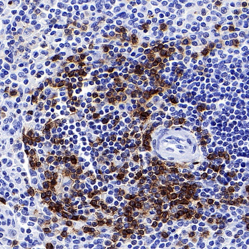 Mouse Anti-Human CD45RO Antibody (UCHL1)