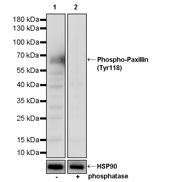 Phospho-Paxillin (Tyr118) Recombinant Rabbit mAb (S-4990)
