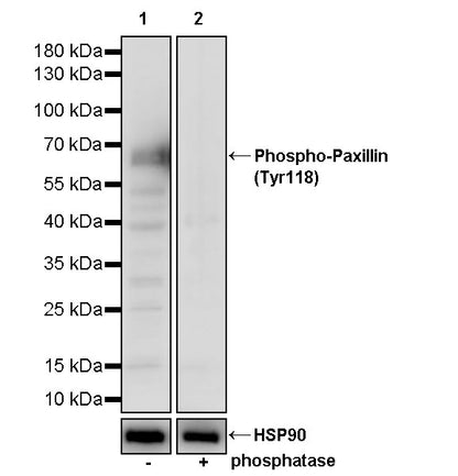 Phospho-Paxillin (Tyr118) Recombinant Rabbit mAb (S-4990)