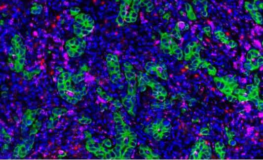 Absin 4-Color IHC Kit (Anti-Rabbit and Mouse Secondary Antibody)