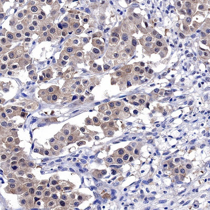 SH-PTP2 Recombinant Rabbit mAb (S-1318-2)