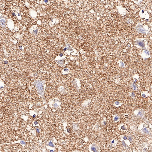 NDRG2 Recombinant Rabbit mAb (S-618-76)