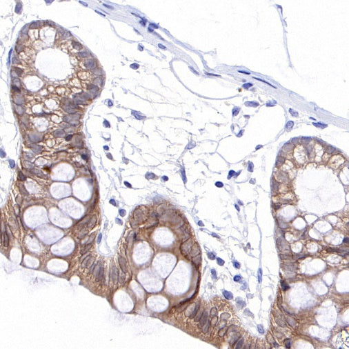 Caspase-7 Recombinant Rabbit mAb (S-782-50)