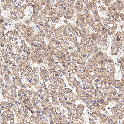 ASGR1 Rabbit Polyclonal Antibody
