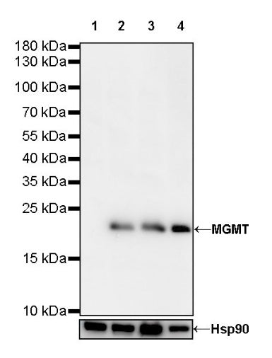MGMT Recombinant Rabbit mAb (SDT-522-71)