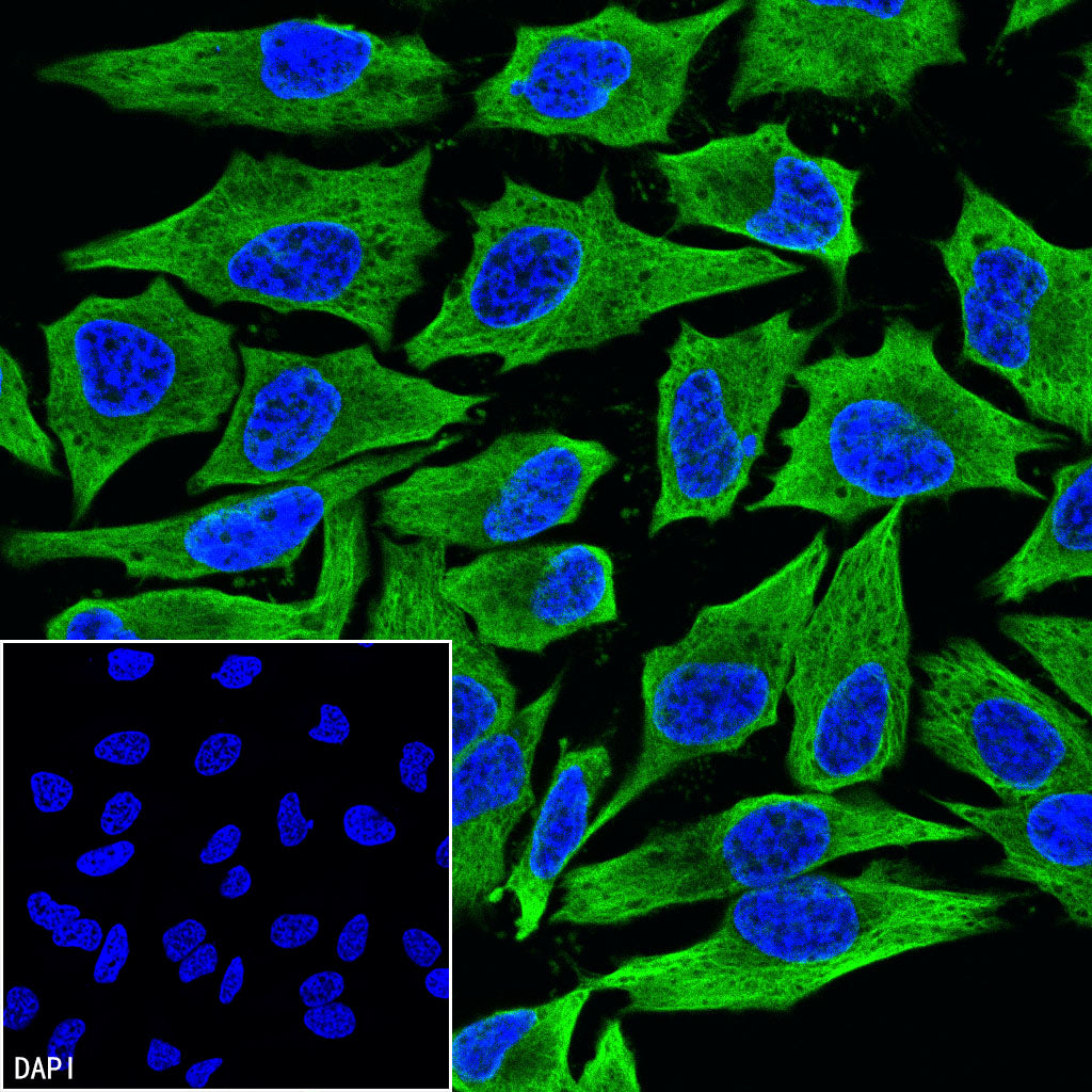Beta Tubulin Recombinant Mouse mAb (S-5422)