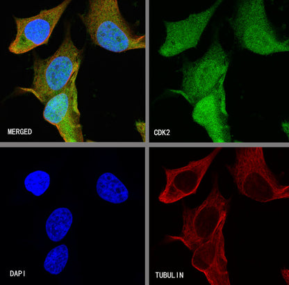 CDK2 Recombinant Rabbit mAb (SDT-064-40)