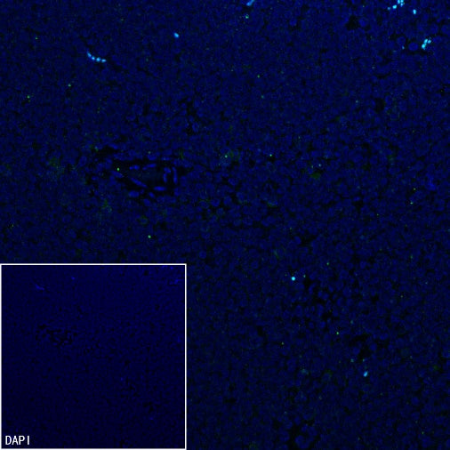 RNF17 Recombinant Rabbit mAb (S-3660-61)