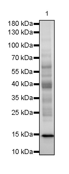 Acetyllysine Recombinant Rabbit mAb (SDT-R096)