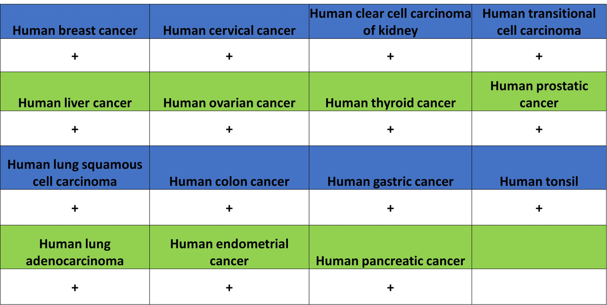 CLPP Recombinant Rabbit mAb (S-4169-31)