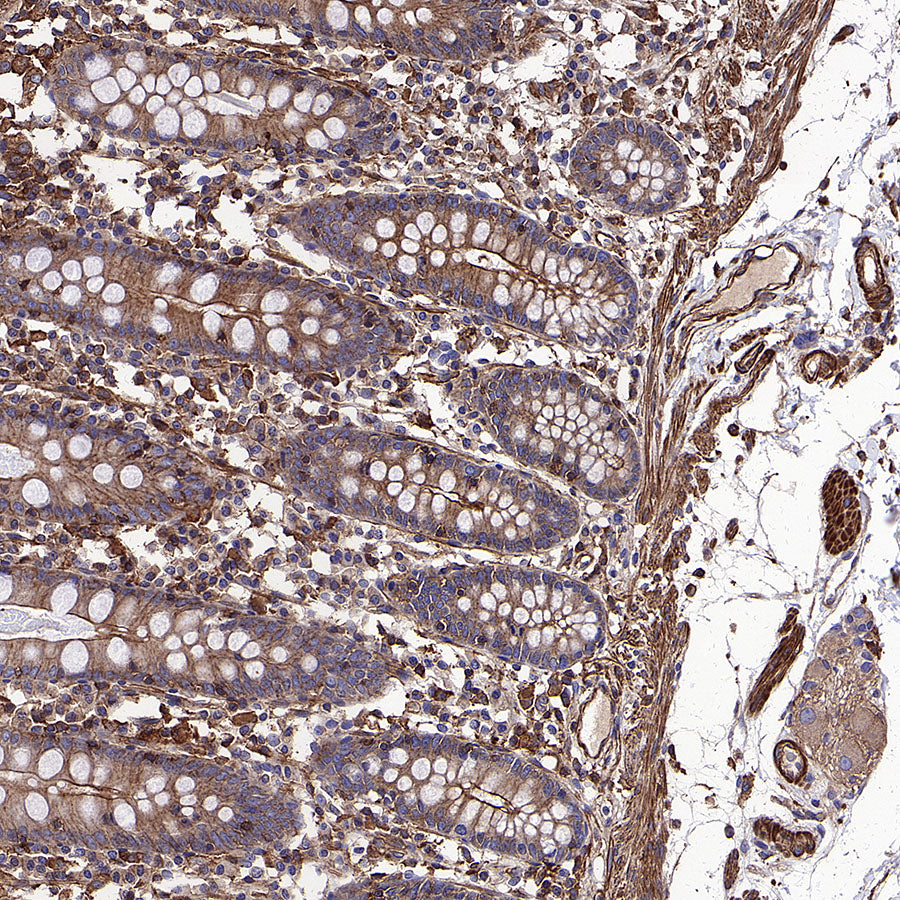 Beta Actin Recombinant Mouse mAb (S-5033)