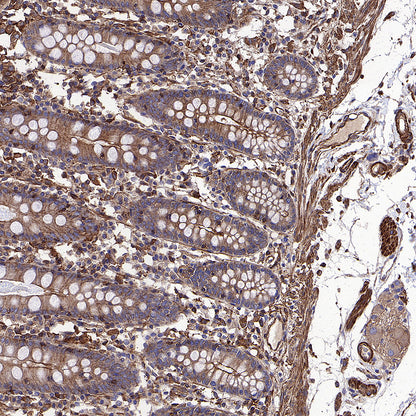Beta Actin Recombinant Mouse mAb (S-5033)