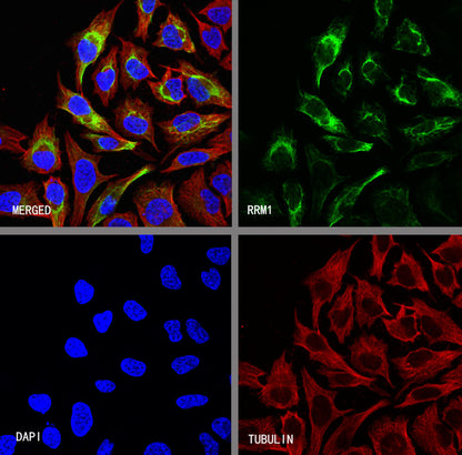 RRM1 Recombinant Rabbit mAb (SDT-R152)