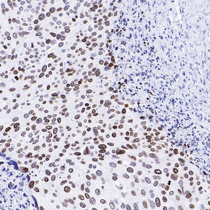 Histone H3 (acetyl K23) Recombinant Rabbit mAb (S-3321-202)
