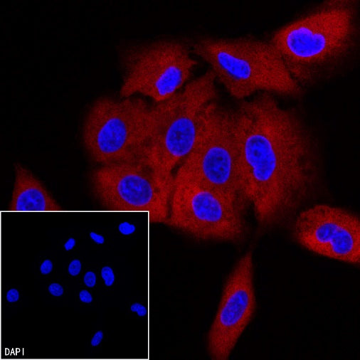 FASN Recombinant Rabbit mAb (PE Conjugate) (S-682-32)