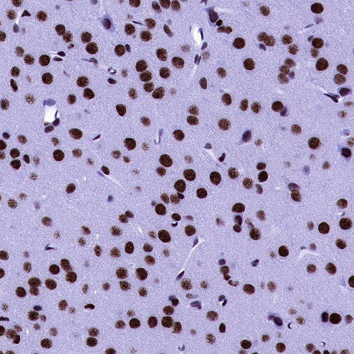 U2AF2 Recombinant Rabbit mAb (S-1324-66)