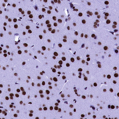 U2AF2 Recombinant Rabbit mAb (S-1324-66)
