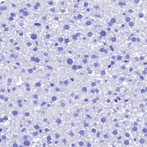 EGR2 Recombinant Rabbit mAb (S-741-136)