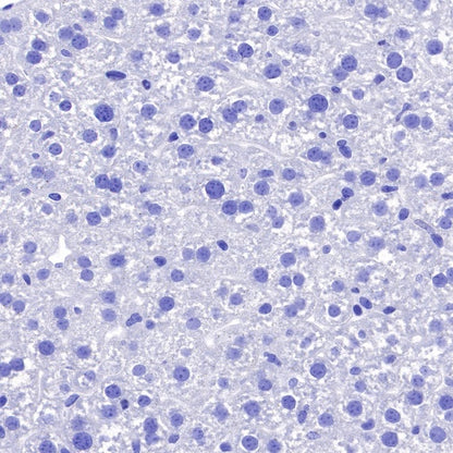 EGR2 Recombinant Rabbit mAb (S-741-136)