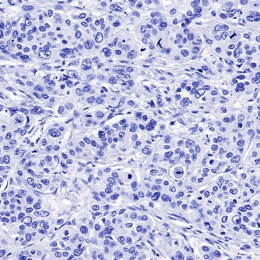 FGFR2b Recombinant Rabbit mAb (SDT-423-121)