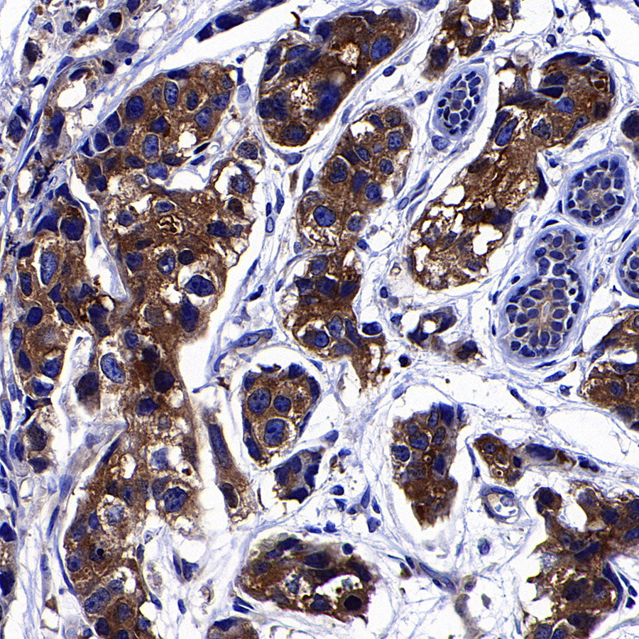 GFPT1 Recombinant Rabbit mAb (S-4752-19)