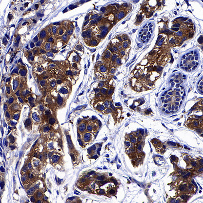 GFPT1 Recombinant Rabbit mAb (S-4752-19)