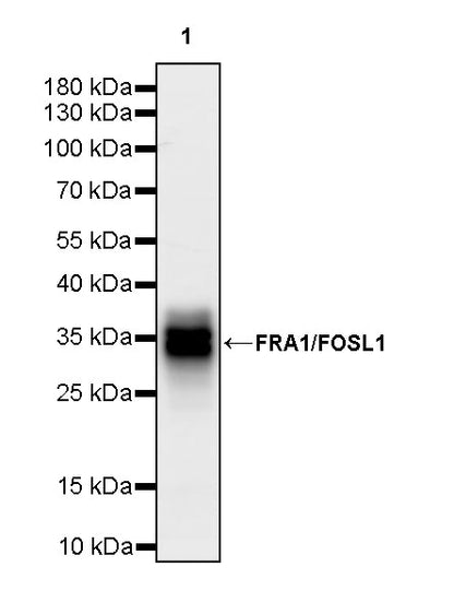 FRA1/FOSL1 Recombinant Rabbit mAb (S-3772-68)