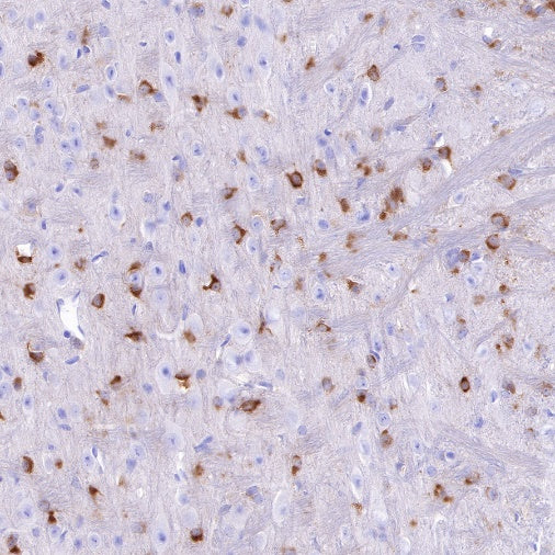 Alpha B Crystallin Recombinant Rabbit mAb (S-R216)