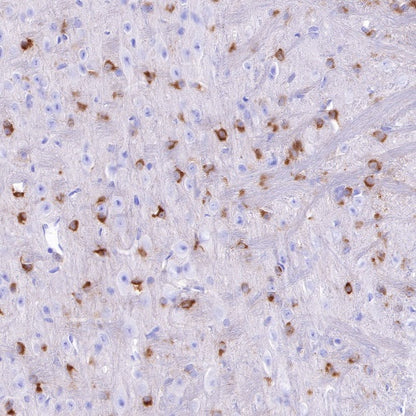 Alpha B Crystallin Recombinant Rabbit mAb (S-R216)