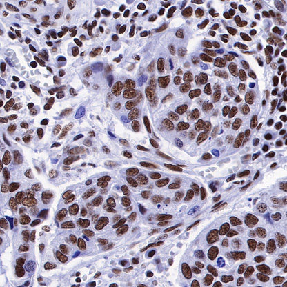 Ku80 Recombinant Rabbit mAb (S-R226)