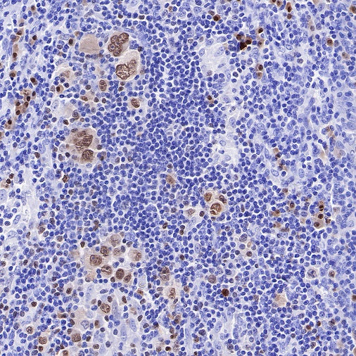 IRF4 Recombinant Rabbit mAb (S-654-33)