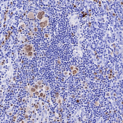 IRF4 Recombinant Rabbit mAb (S-654-33)