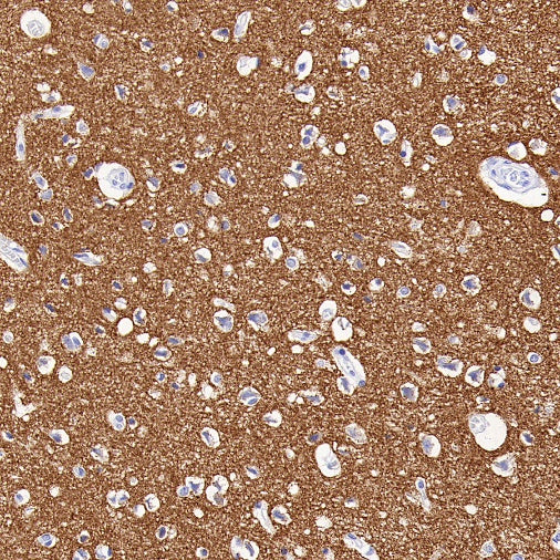 SV2A Recombinant Rabbit mAb (S-2096-2)