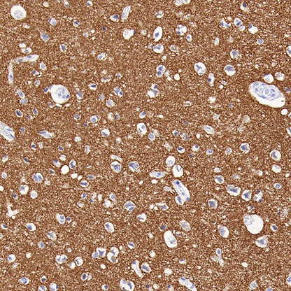 SV2A Recombinant Rabbit mAb (S-2096-2)