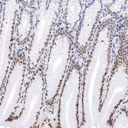 JunB Recombinant Rabbit mAb (S-R294)