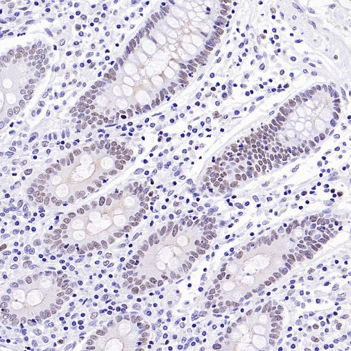 Caspase-8 Recombinant Rabbit mAb (S-2676-74)